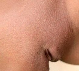 Мелания — фото 13